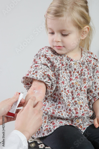 Mother applaying ointment onto red and itchy eczema on her daughter's arm. Toddler girl suffering from atopic dermatitis.