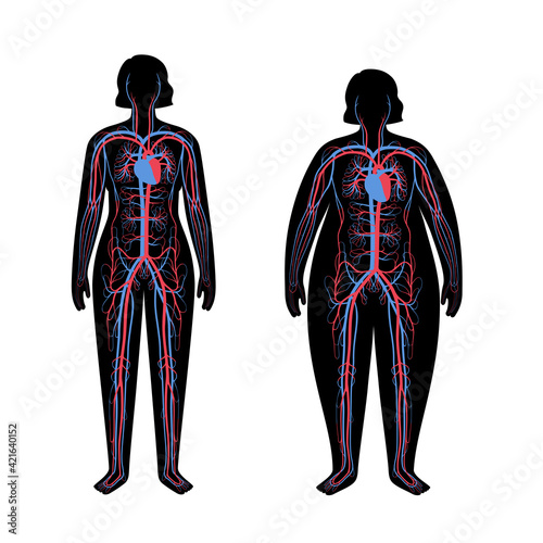 Blood system in obese body