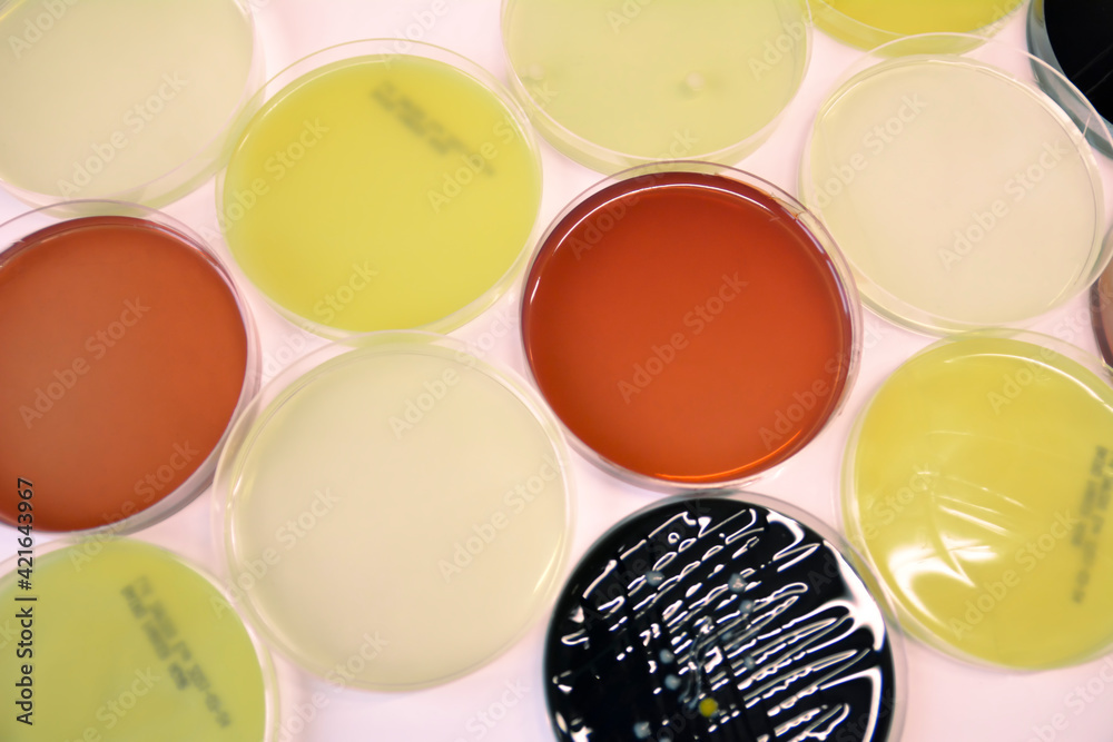 Petri dishes in Microbiology Laboratory Stock Photo Adobe Stock