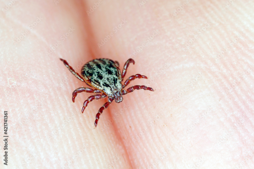 Obraz premium Lyme disease-carrier Ixodes tick Dermacentor marginatus on human skin. 