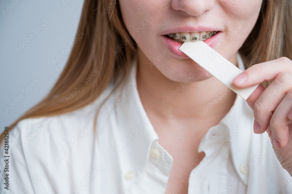 Young woman with metal braces on her teeth is chewing gum. The girl is eating gummy candy Young woman with metal braces on her teeth is chewing gum. The girl is eating gummy candy