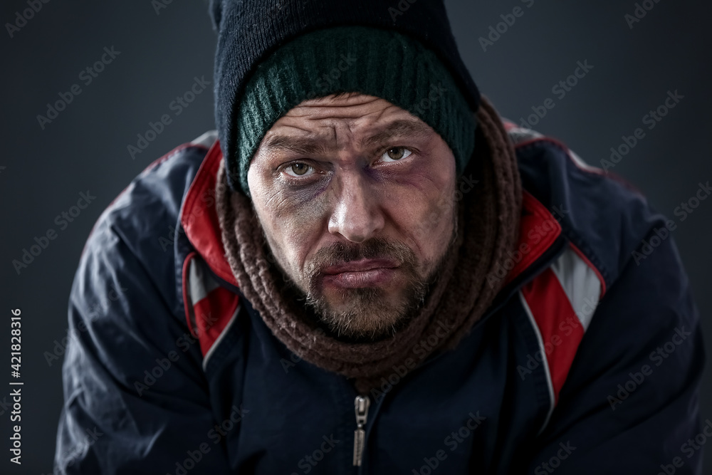 Portrait of poor homeless man on dark background