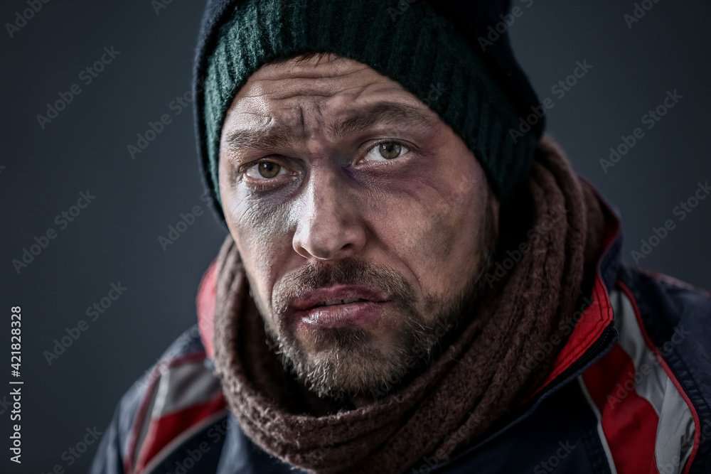 Portrait of poor homeless man on dark background