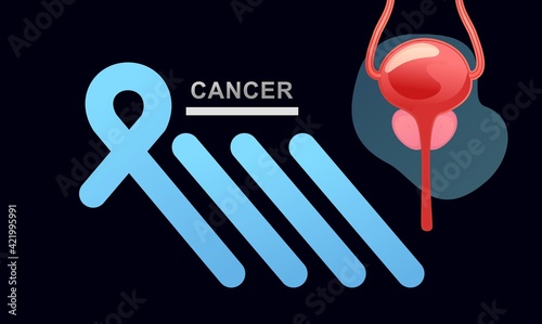 concept vector banner human prostate,