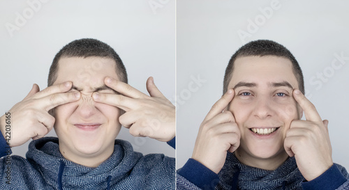 Before and after. On the left the man indicates eyes pain, and on the right, indicates that the eyes no longer hurts. Medical care assistance concept in the treatment of conjunctivitis and eye fatigue photo