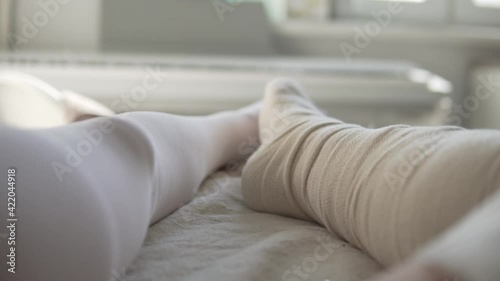 Close-up of the woman's leg in the cast of the longet when the Achilles tendon ruptured. photo