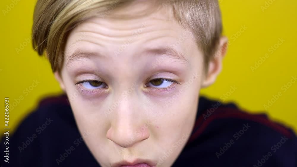 The boy brings his eyes to his nose and shows funny faces. The child stands on a yellow background and shows emotions The boy brings his eyes to his nose and shows funny faces. The child stands on a yellow background and shows emotions