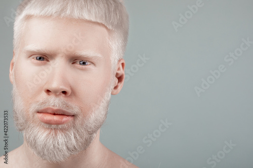 Portrait of albino bearded man with white hair and pale skin looking at camera, grey background with free space photo