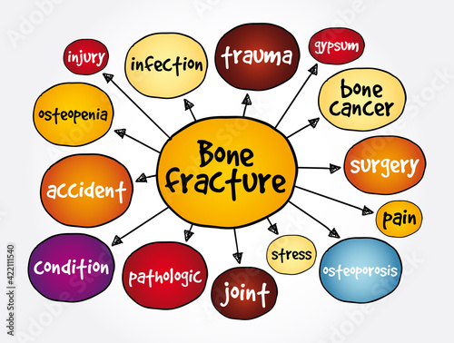 Bone fracture mind map, concept for presentations and reports