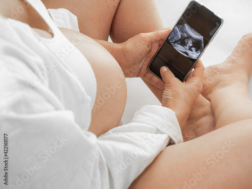Obraz na plátně A pregnant woman in white clothes with a bare big belly sits in a white room and looks at an ultrasound scan of her unborn child