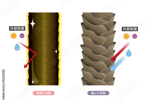 Hair cross section 17_4