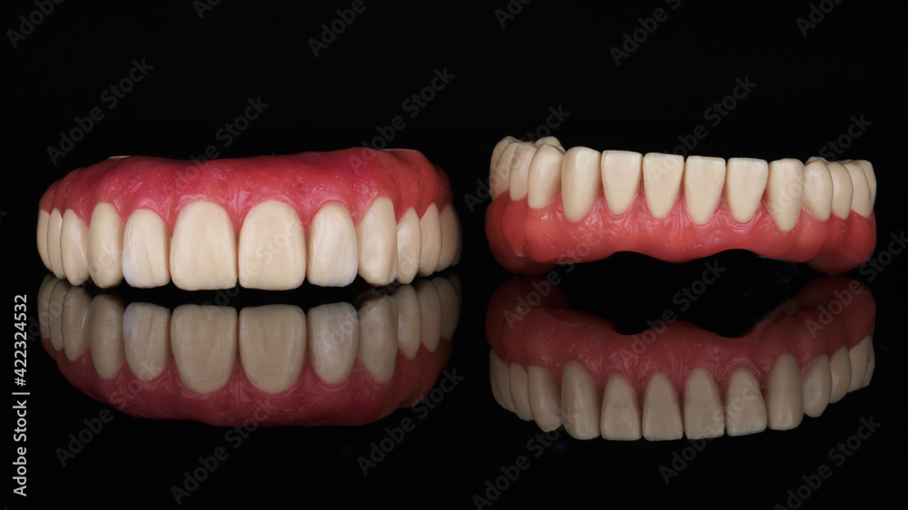 maxillary and mandibular wax up with pink gums on a black background with reflection maxillary and mandibular wax up with pink gums on a black background with reflection