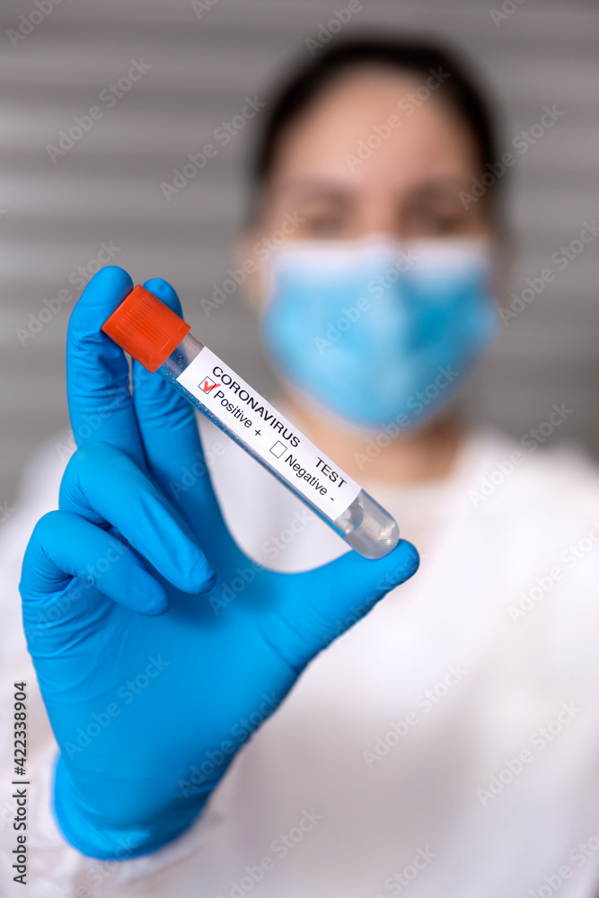 Unrecognizable nurse showing a test tube with a positive sample of Covid-19 virus. Selective focus. Unrecognizable nurse showing a test tube with a positive sample of Covid-19 virus. Selective focus.