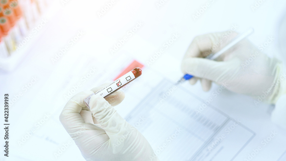 Doctor diagnose a test tube of blood to make a to make a medical diagnosis in laboratory