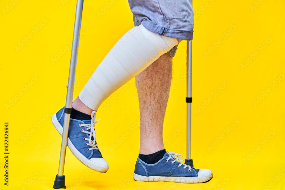 Legs of a man in right profile wearing shorts and on crutches, with a bandaged leg, on yellow background