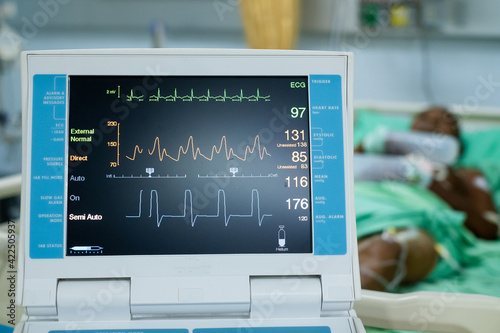 EKG monitor in intra aortic balloon pump machine. Medical equipment in hospital. Medical Technology 	 photo