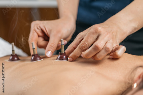 Moxibustion Therapy     Traditional Chinese Medicine