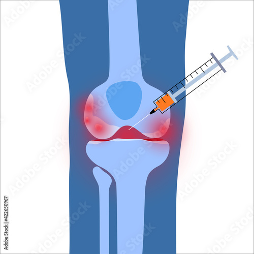 Knee Injection concept