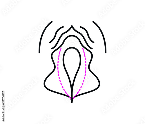 vector vagina plastic surgery concept. medical operation Gynecology. Isolated illustration.
