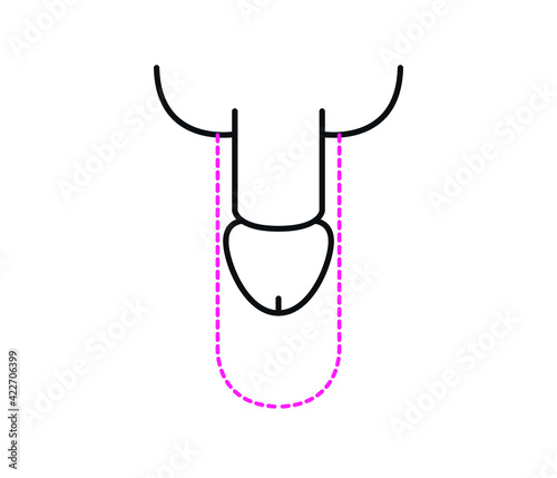 Penis surgery. Penis isolated on white background.
