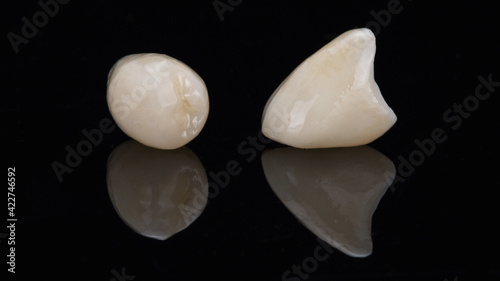 two dental ceramic crowns on black glass with reflection