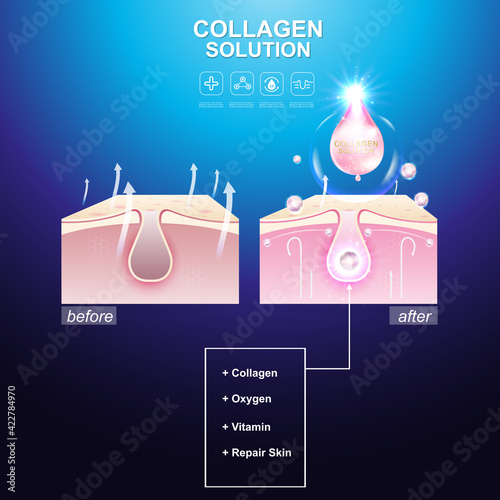 Repair Skin Layer , Collagen Serum and Vitamin Repair Skin Concept.