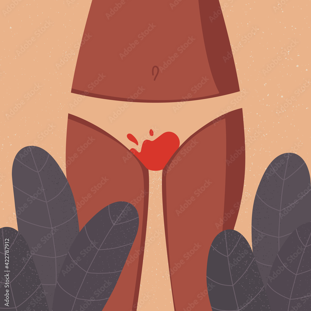 Menstrual period concept. Womens thighs with blood-stained panties.  Feminine hygiene. Menstrual protection. Vector stock illustration. For  website and article design, application and print. Stock Vector
