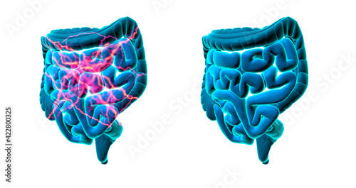 Stomach pain and abdominal pain, visualizing stabbing pain and the small and large intestine without pain, 3d illustration photo