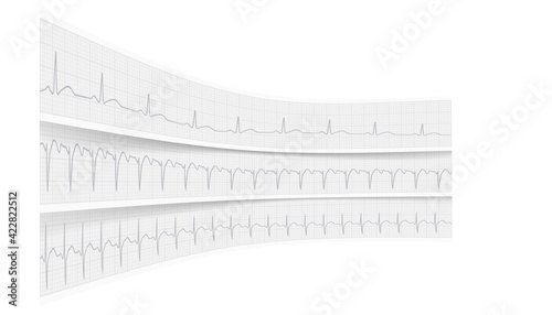 ECG waves on paper realistic drawing, vector