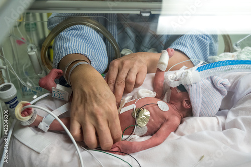 Mother caring premature newborn baby in incubator photo