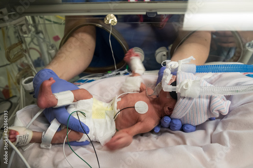 Nurse caring premature newborn baby in incubator

