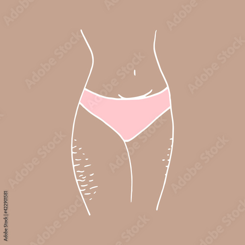 female hips with stretch marks - vector sketch. Cartoon style vector illustration of the lower body of a woman in pink underpants