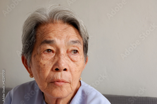 Face focus of Elderly Asian woman with grey hair and freckles and wrinkled skin and eye is cataract or pterygium, Aging society and Various illnesses of the elderly and good health concept photo