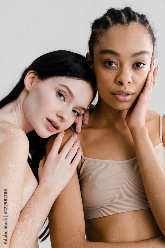 African young woman standing with caucasian woman African young woman standing with caucasian woman