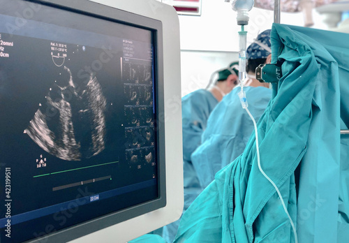 Transesophageal Echocardiography (TEE) during open heart surgery. photo