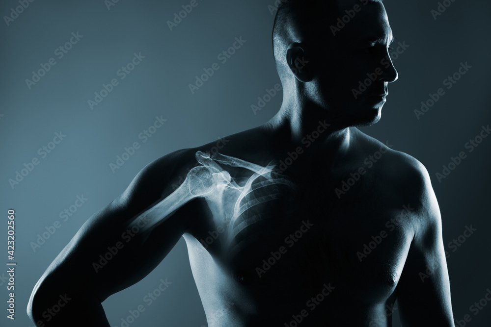 Fototapeta premium Human shoulder joint in x-ray on gray background