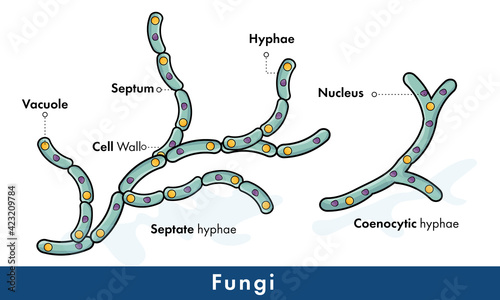 Structure of fungi, septate and coenocytic hyphae.