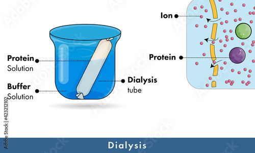 Molecular Mechanism of dialysis.