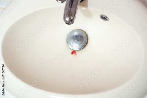 Bloody saliva in washbasin. Person washes away the blood