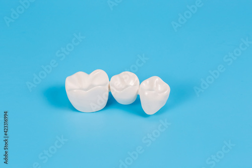Plastic dental crowns, imitation of a dental prosthesis of a dental bridge