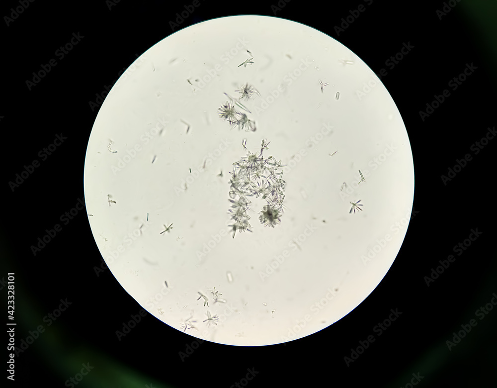 Urine Microscopic Examination Under 40x Light Microscope With Tyrosine Crystal And Mucous 5316