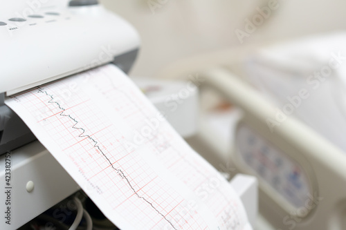 Photographie Fetal monitor with Printing of cardiogram by Electrocardiograph