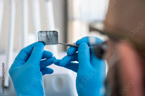 Dentist looks at X-ray of teeth photo
