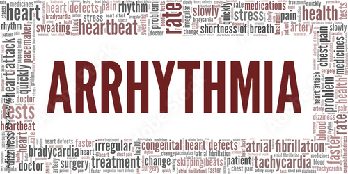 Arrhythmia vector illustration word cloud isolated on a white background.