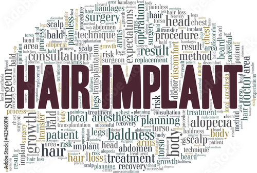 Hair implant vector illustration word cloud isolated on a white background.