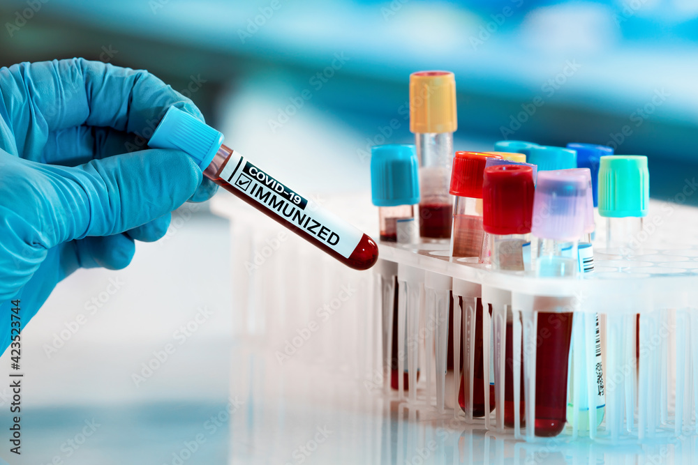 Doctor in the lab holding a tube of blood sample identified with the label Covid-19 IMMUNIZED. Laboratory Technician with a blood sample from a patient immunized against the Coronavirus covid-19 virus Doctor in the lab holding a tube of blood sample identified with the label Covid-19 IMMUNIZED. Laboratory Technician with a blood sample from a patient immunized against the Coronavirus covid-19 virus