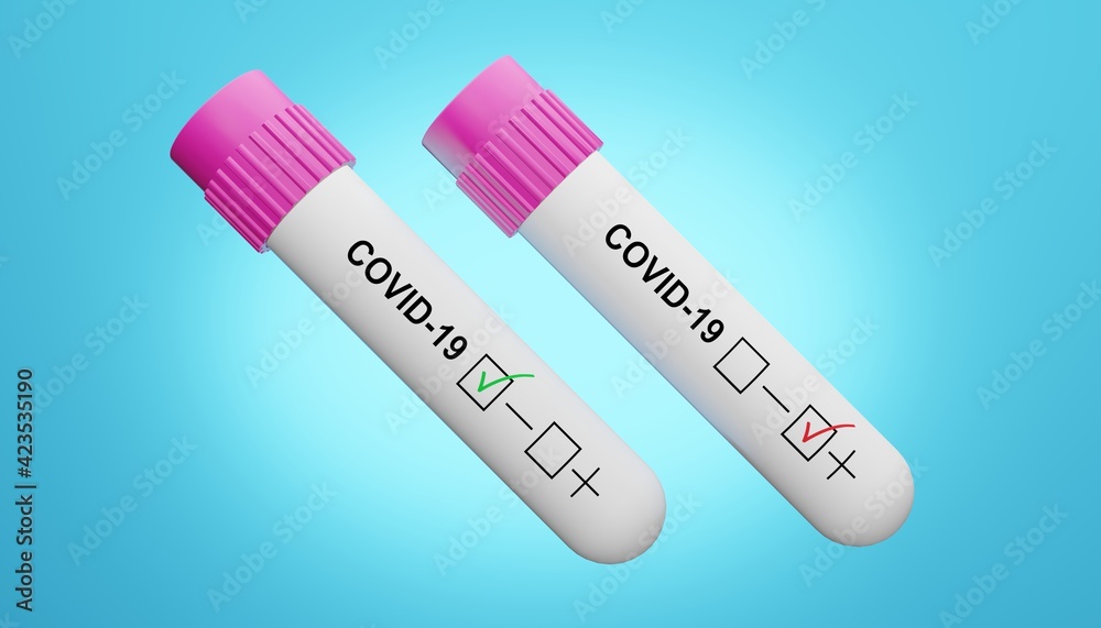 3D render of negativ and positive covid-19 test.Medical concept of outbreak of life-threatening Covid-19 virus.Illustration of a digital image for medicine. 3D render of negativ and positive covid-19 test.Medical concept of outbreak of life-threatening Covid-19 virus.Illustration of a digital image for medicine.