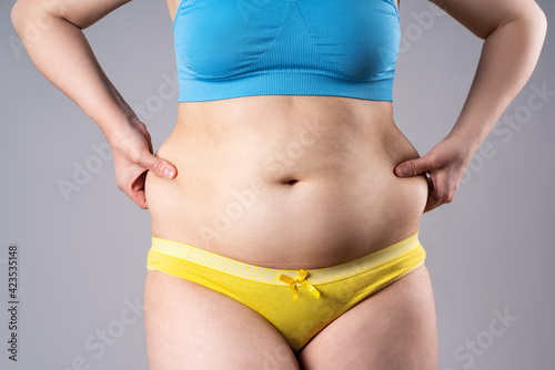 Tummy tuck, flabby skin on a fat belly, plastic surgery concept