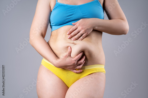 Wallpaper Mural Tummy tuck, flabby skin on a fat belly, plastic surgery concept Torontodigital.ca