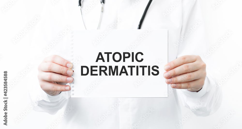 The doctor holds a business card in front of her with the text ATOPIC DERMATITIS. The doctor holds a business card in front of her with the text ATOPIC DERMATITIS.